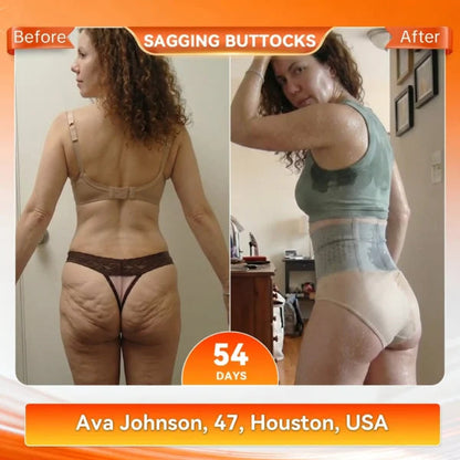 🥳2026 HOT SALE🥳💞95K+ SOLD!🌸Thermogenic Fat-Burning Sculpting Shorts| 30-Min Daily Shaping Support