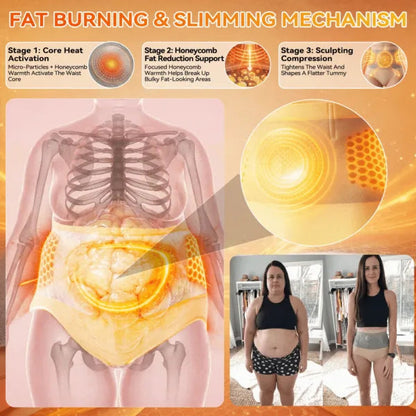 🥳2026 HOT SALE🥳💞95K+ SOLD!🌸Thermogenic Fat-Burning Sculpting Shorts| 30-Min Daily Shaping Support