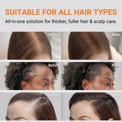 🐤Lilyeve™ GrowTurn Hair Brush Serum