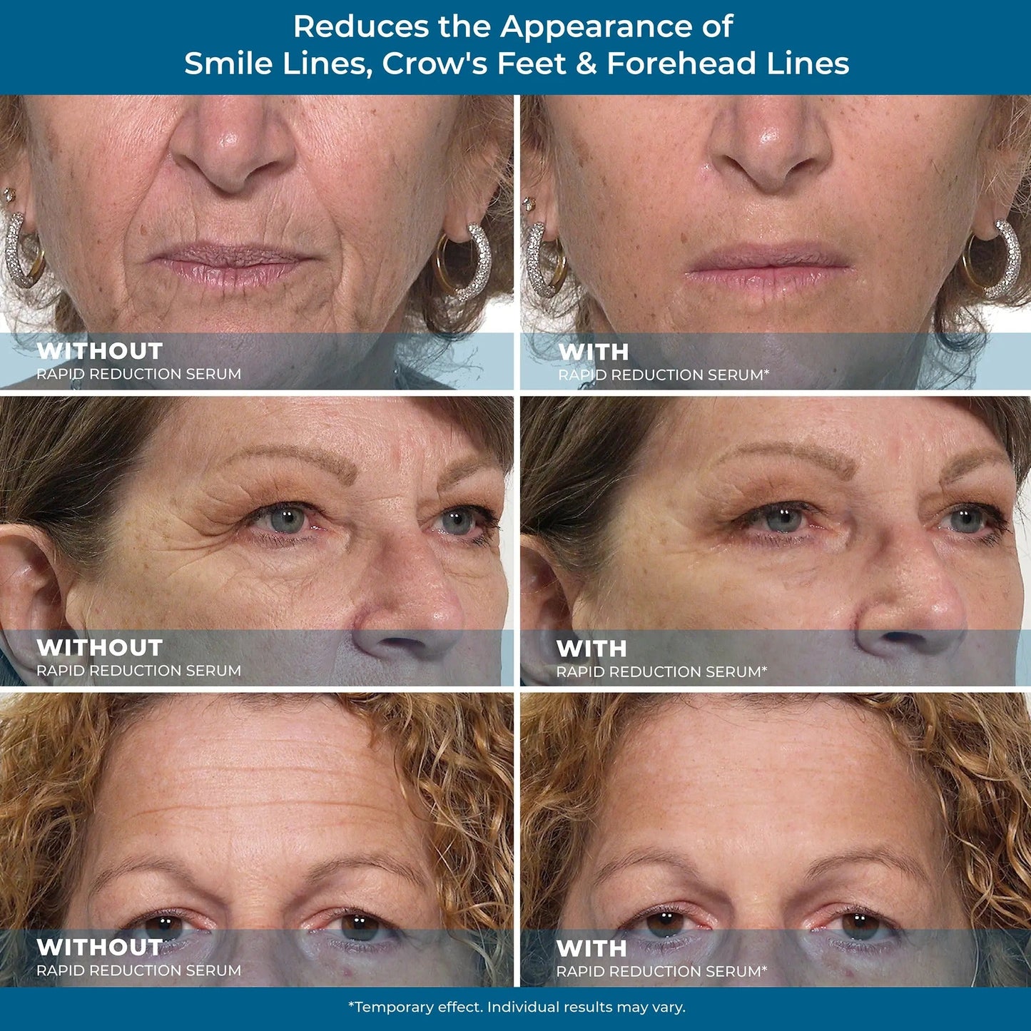 Plexaderm Rapid Reduction Eye Serum - Anti Aging Wrinkle Remover for Face, Scientific formula for easy absorption without greasiness10ml Tightening Skincare Comfort-HS